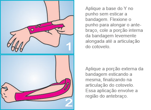 Aplicação Cotovelo
