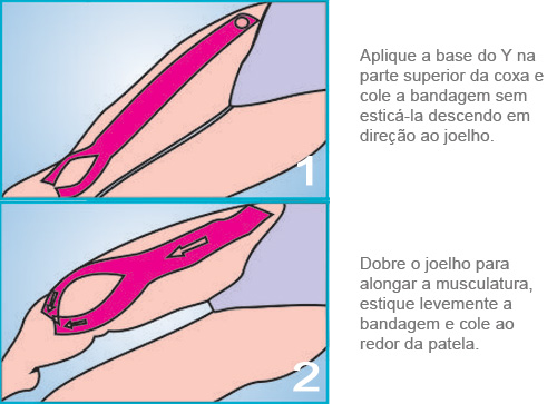 Aplicação Joelho