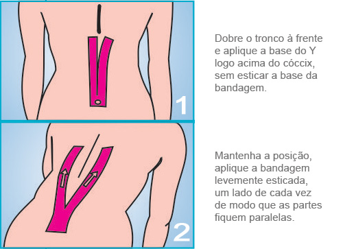 Aplicação Lombar