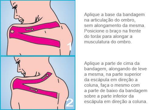 Aplicação Ombro